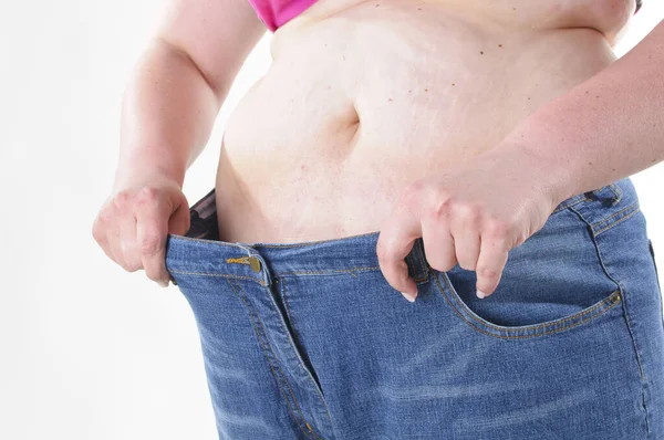 太りすぎの大人の女性はすでに多くの重量を失っており 白い背景を背景に 大きなパンツに彼女を示しています — ストック写真