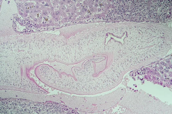 liver mouse,schistosomiasis diseased tissue 100x