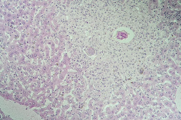 Ratón Hígado Esquistosomiasis Tejido Enfermo 100X — Foto de Stock
