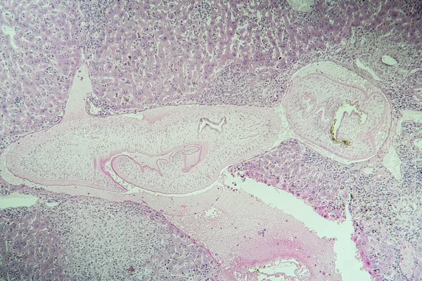 Souris Hépatique Schistosomiase Tissu Malade 100X — Photo