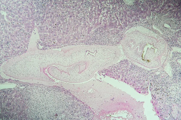 肝マウス住血吸虫症組織100X — ストック写真