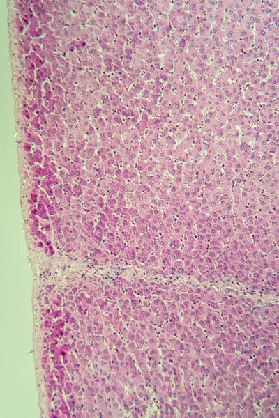 Leber Vom Schwein Unter Dem Mikroskop — Stockfoto