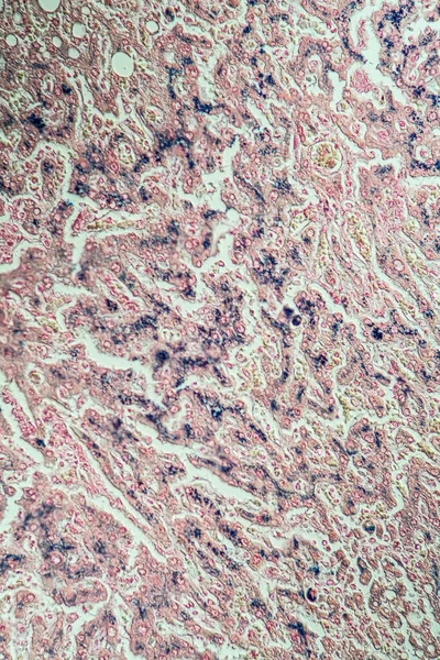 Hígado Bajo Microscopio 200X — Foto de Stock