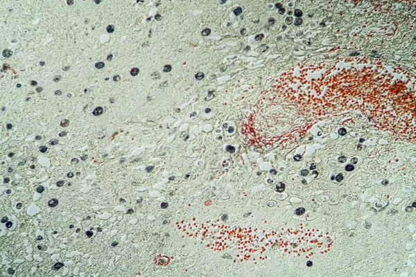 Parasitengewebe Unter Dem Mikroskop 200X — Stockfoto