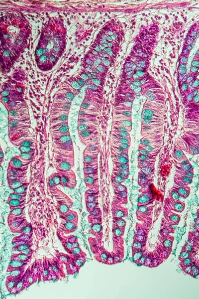 Intestin Grêle Avec Villosités Intestinales Microscope 200X — Photo
