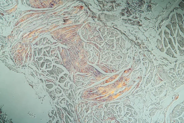 Tessuto Malato Microscopio 200X — Foto Stock