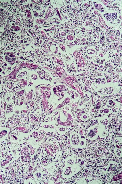 Rehbock Con Gusanos Bajo Microscopio — Foto de Stock