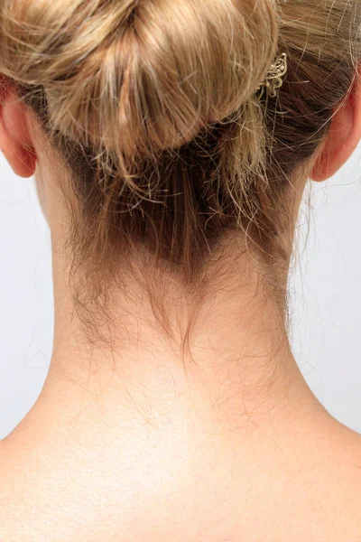 Nape Young Woman Neck — Foto de Stock