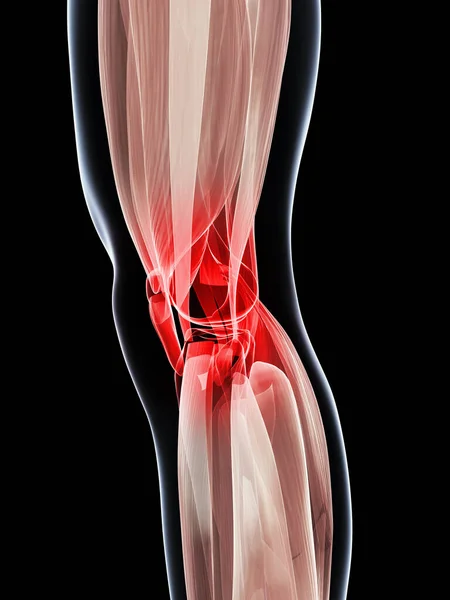 Представила Иллюстрацию Болезненного Колена — стоковое фото