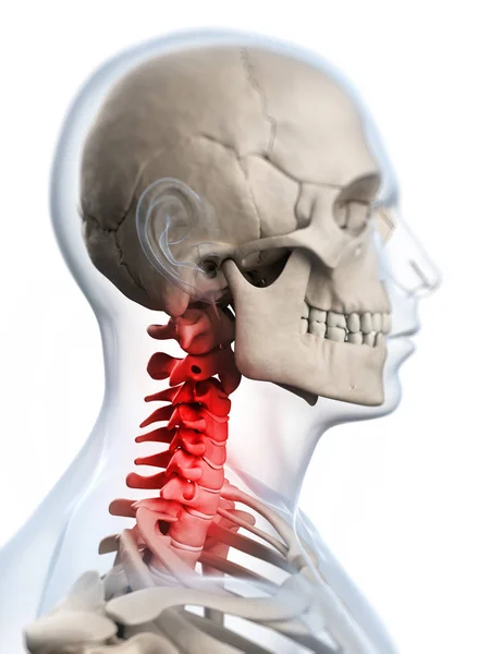 痛み首の レンダリングされた図 — ストック写真