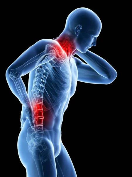 Rendered Illustration Man Having Painful Back Neck — Stock Photo, Image