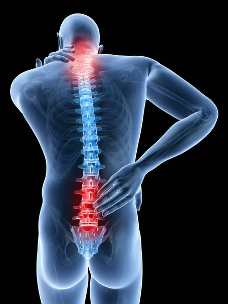 3D描绘了一个人的背颈疼痛 — 图库照片