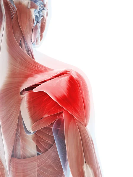 Rendered Illustration Painful Shoulder — Stock Photo, Image