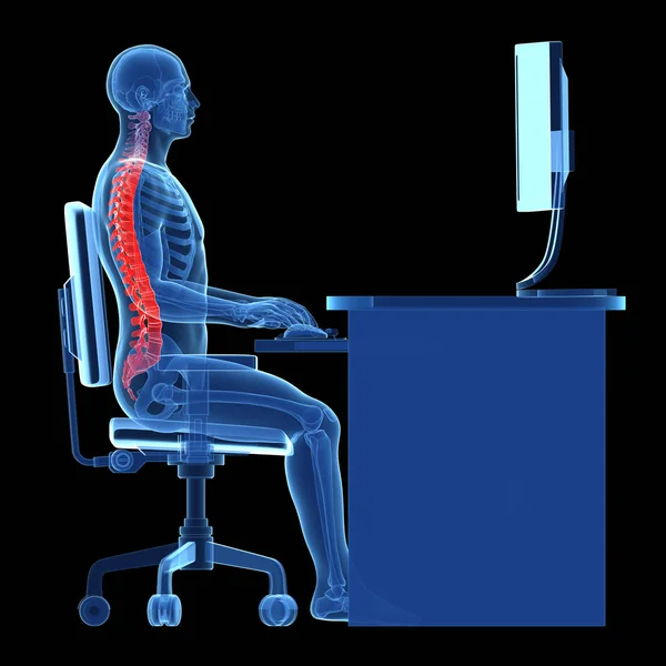 3Dレンダリング医療イラスト 正しい座位姿勢 — ストック写真