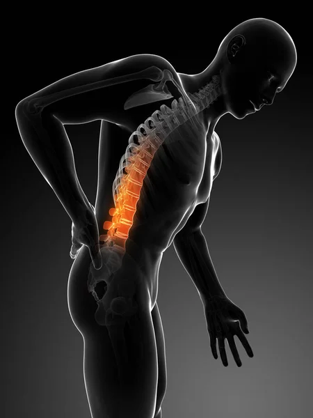 Gerenderte Illustration Rückenschmerzen Männlich — Stockfoto