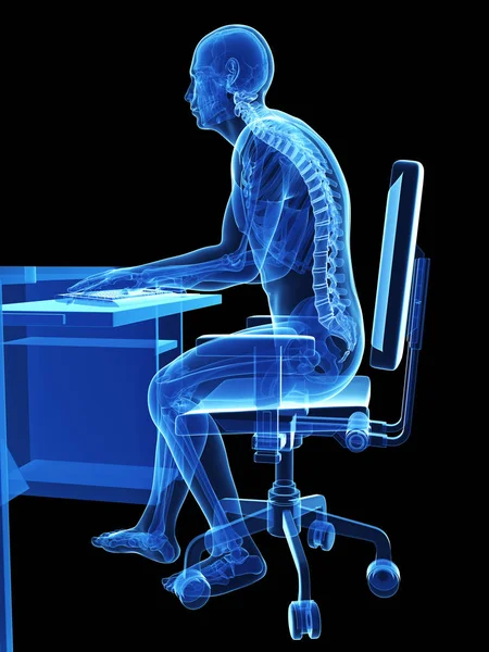 Renderizado Ilustración Médica Postura Sentada Equivocada —  Fotos de Stock