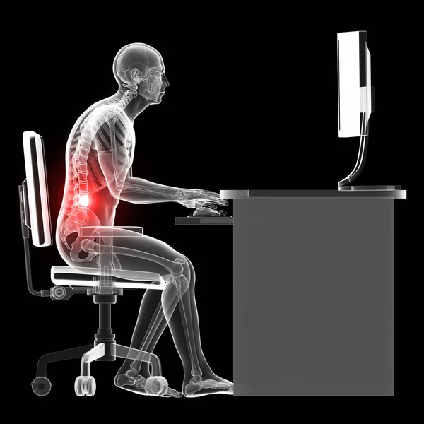 Ilustração Renderizada Homem Que Trabalha Postura Sentada Errado — Fotografia de Stock