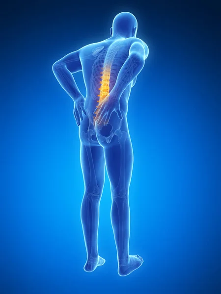 Renderizado Ilustración Dolor Espalda Masculino — Foto de Stock