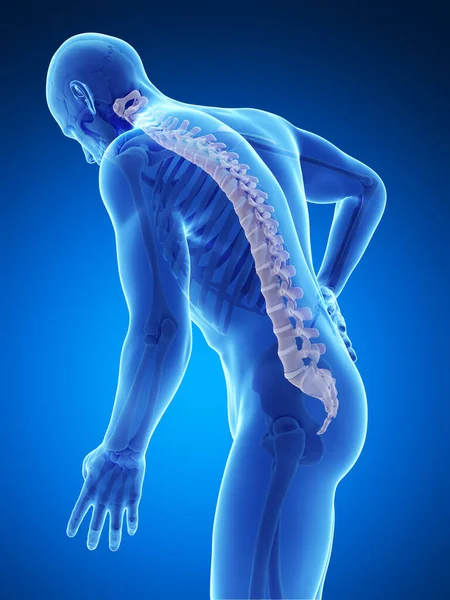 Gerenderte Illustration Rückenschmerzen Männlich — Stockfoto