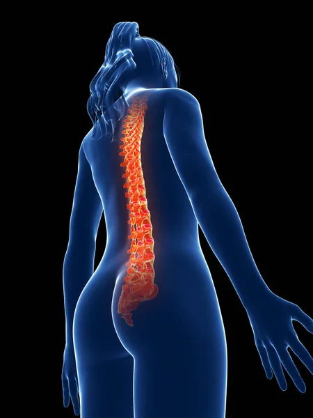 Gerenderte Medizinische Illustration Schmerzhafte Wirbelsäule — Stockfoto