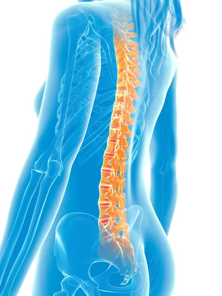 Rendido Ilustración Médica Columna Vertebral Dolorosa — Foto de Stock