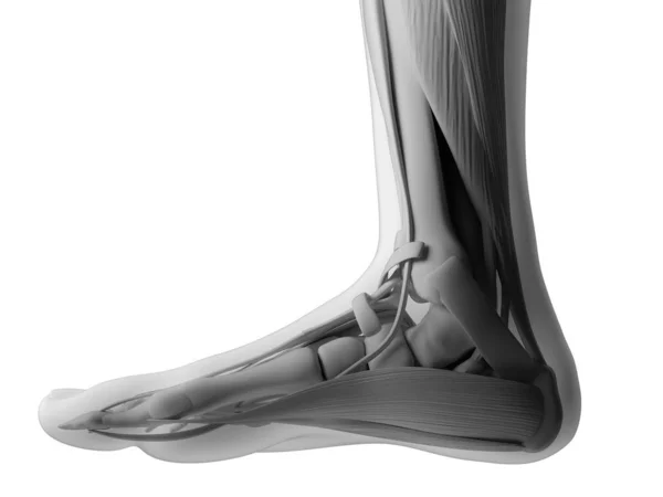Τετηγμένα Εικονογράφηση Του Ανθρώπινο Πόδι — Φωτογραφία Αρχείου