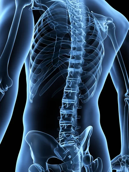 Ιατρική Απεικόνιση Της Σκελετικής Πλάτης — Φωτογραφία Αρχείου