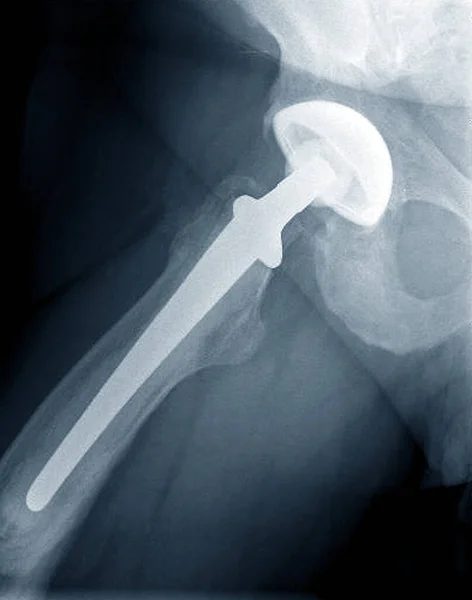 Анатомічний Рентген Діагностика Захворювань — стокове фото