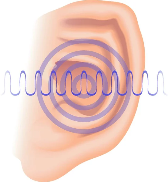 Vector Simbólico Ilustración Médica Los Síntomas Tinnitus — Archivo Imágenes Vectoriales