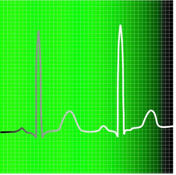 Ecg Moniteur Vert Avec Des Informations Battement Coeur — Image vectorielle