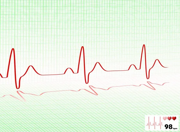Monitor Latidos Cardíacos Ilustrado Con Espacio Lectura Copia — Vector de stock