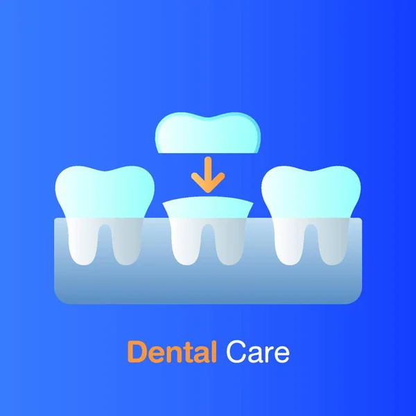 Concepto Cuidado Dental Implante Odontológico Prevención Control Tratamiento Dental Ilustración — Archivo Imágenes Vectoriales