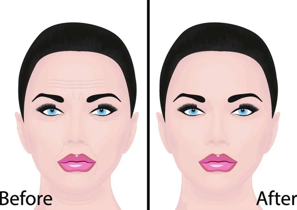 Jeune Vieillissement Visage Rides Traitement Lifting Facial Procédure Cosmétologie Avant — Image vectorielle