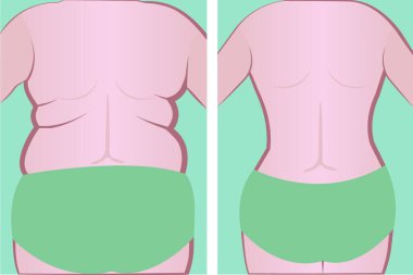 Fat and slim girl before and after vector illusstration clipart
