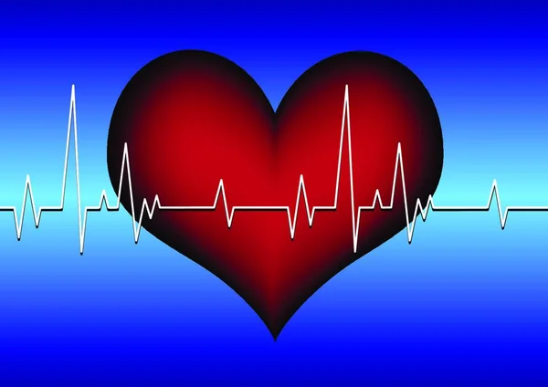 Herz Mit Kardiogramm Auf Rasterhintergrund — Stockvektor