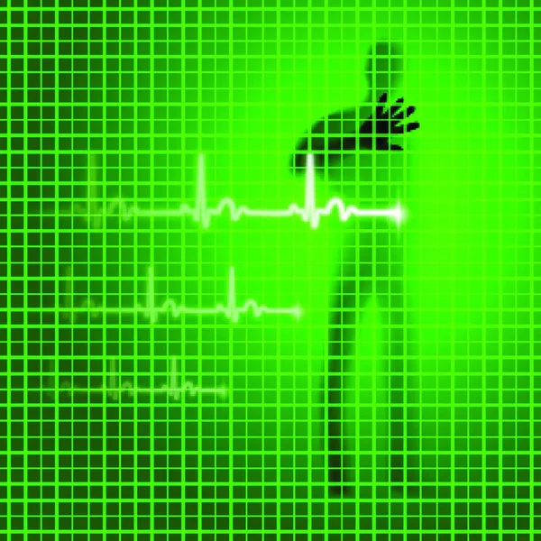 Fondo Medico Verde Con Silhouette Umana Linea Cardiogramma — Vettoriale Stock