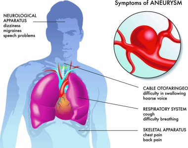 medical illustration of the main symptoms of aneurysm clipart