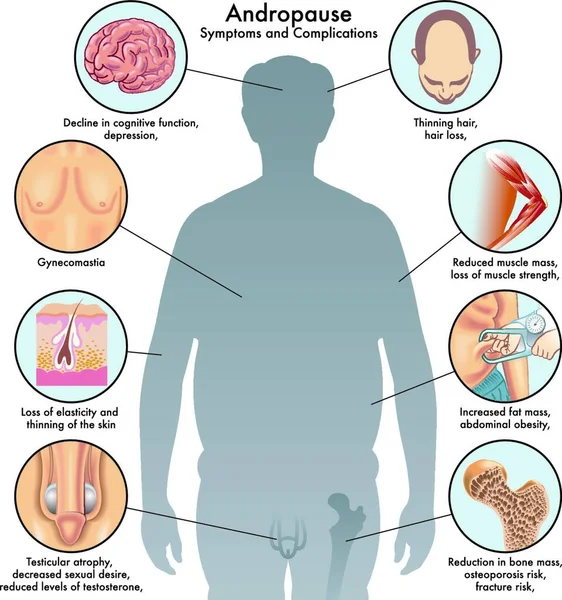 Illustration Médicale Des Symptômes Des Complications Andropause — Image vectorielle