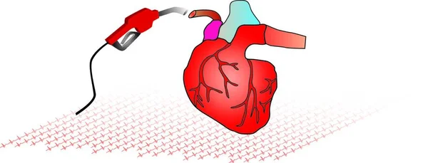 Opieki Nad Sercem Poprzez Transfuzję Krwi Choroby Serca — Wektor stockowy