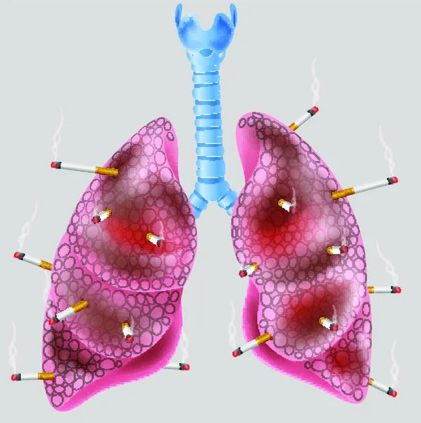 Cigarrillo Pulmón — Archivo Imágenes Vectoriales