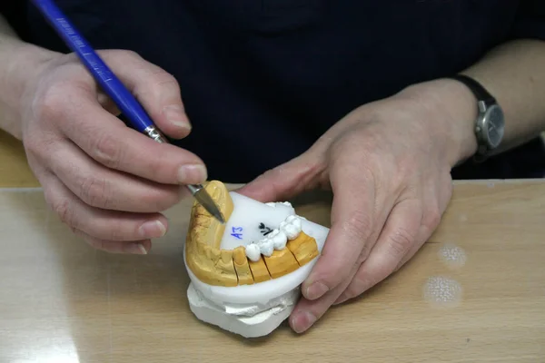 Painting a tooth model