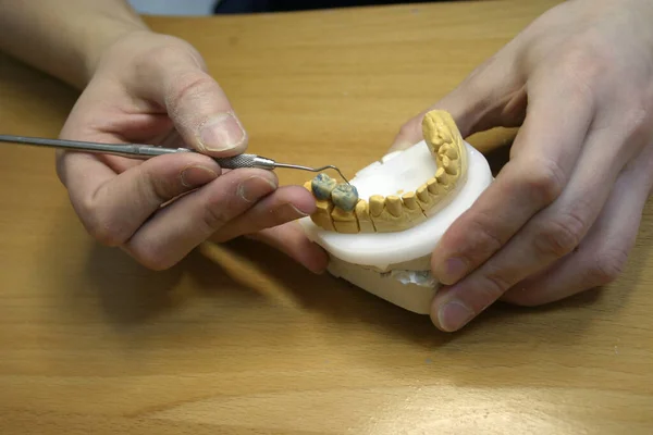 下颌骨的牙齿模型 — 图库照片
