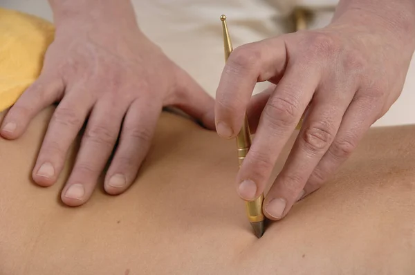 Nahaufnahme Einer Frau Akupunktur Behandlung — Stockfoto