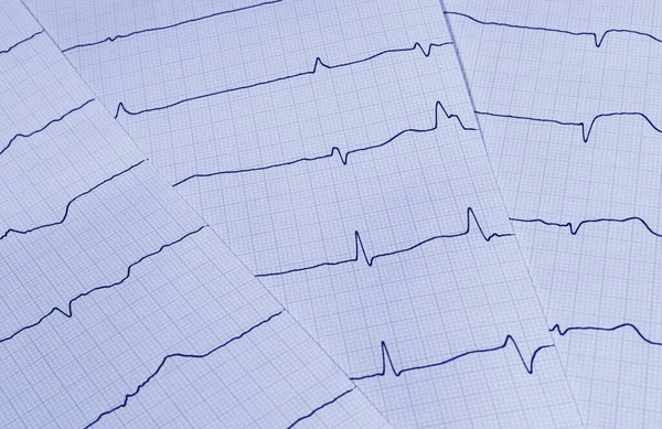 Heartbeat Cardiology Ecg Ambulans — Zdjęcie stockowe