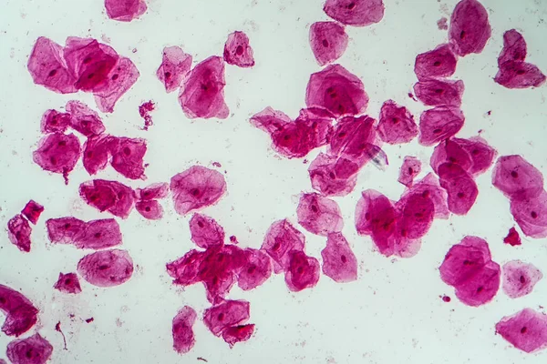 Эпителиальные Клетки Бактериями Полости Рта 200X — стоковое фото