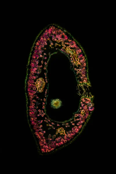 Crowberry Leaves Cross Section 100X — Stock Photo, Image