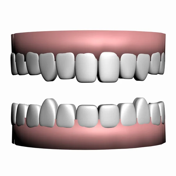Próteses Dentárias Medicina Dos Dentes — Fotografia de Stock