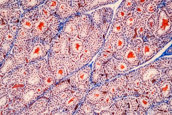 Tissu Thyroïdien Microscope 200X — Photo