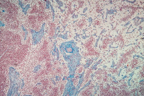 현미경 아래에 림프절 100X — 스톡 사진
