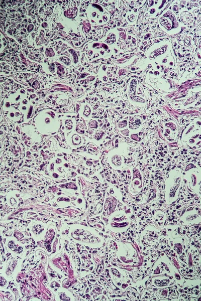 Lungworm Sob Microscópio 200X — Fotografia de Stock